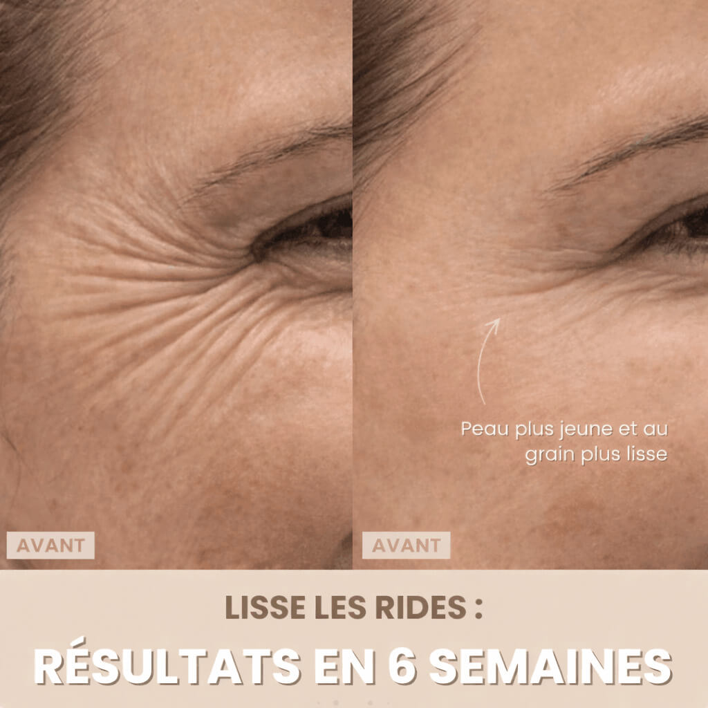 Masseur anti âge